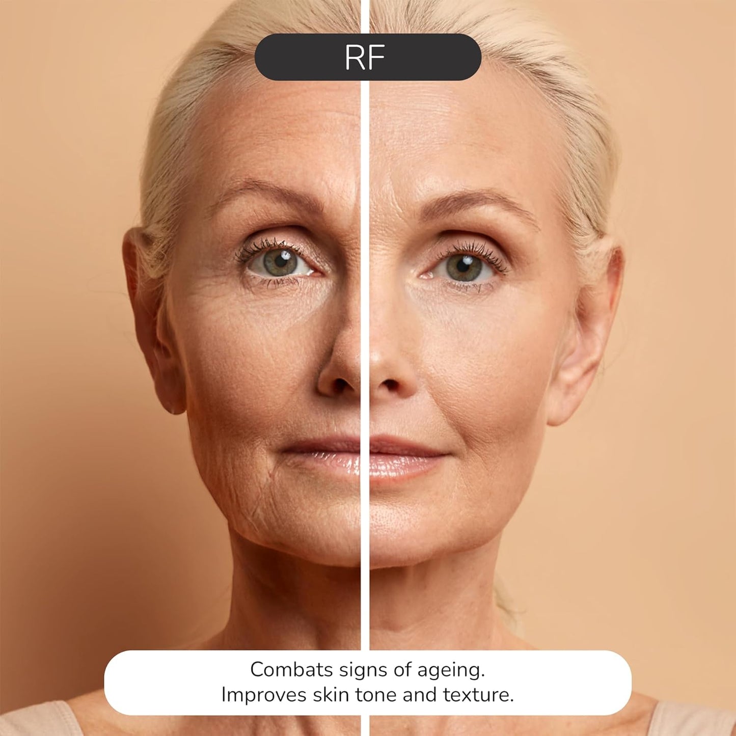 ® Face Massager with Radio Frequency Skin Tightening & EMS Red Light Therapy for Face & Neck Lift – Sculpting Device with 20 Radiofrequency Heads, Portable and Lightweight for Face Toning
