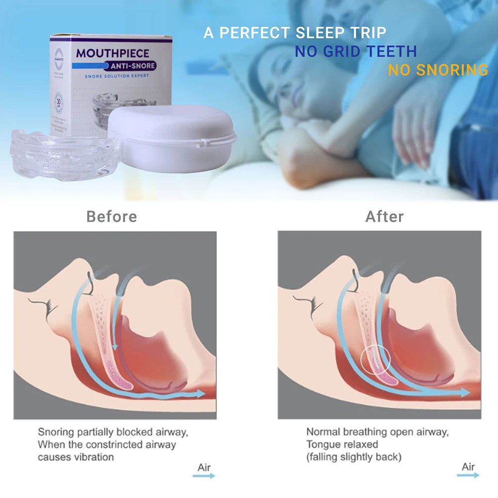 Comfort Mouth Guard β Reusable Bite Guard with Storage Case (Nighttime Protection)