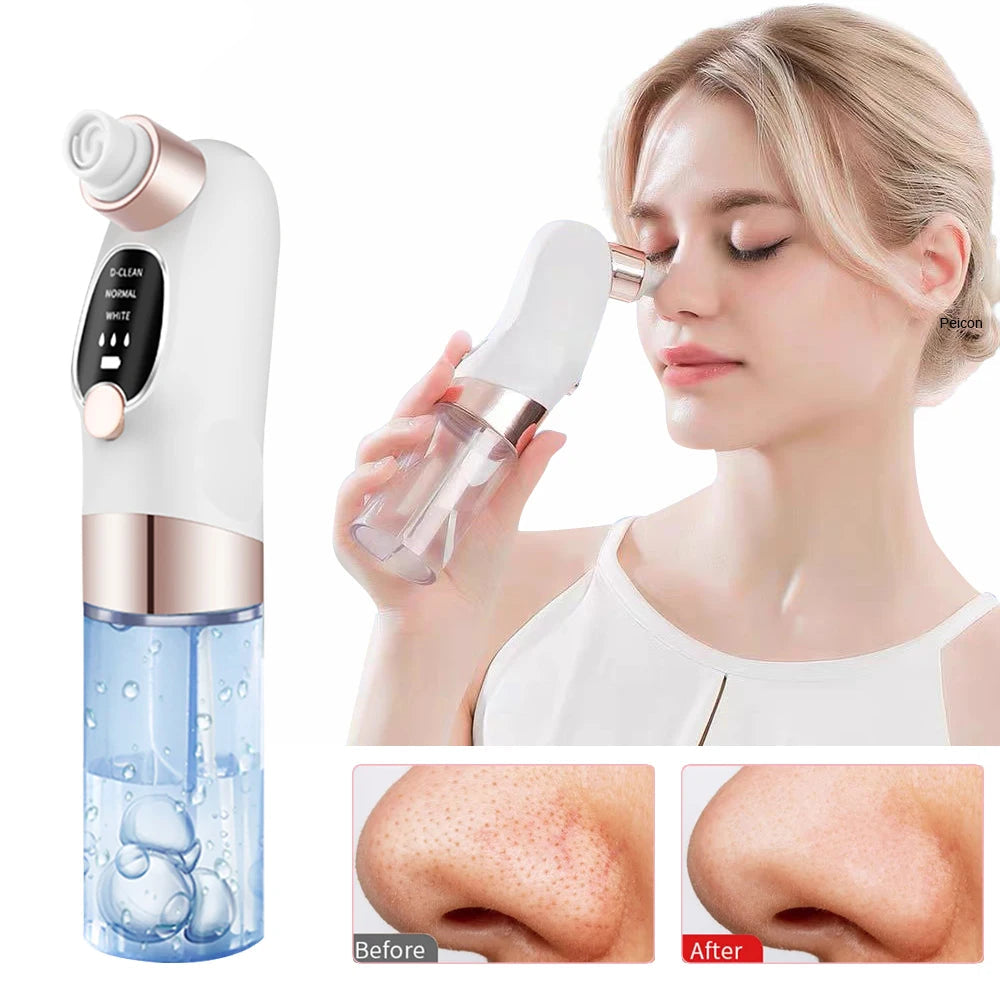 Blackhead Remover Electric BlackHead Extractor Pore Vacuum Cleaner Micro Small Bubble Acne Nose Deep Cleaning Black Head Remover