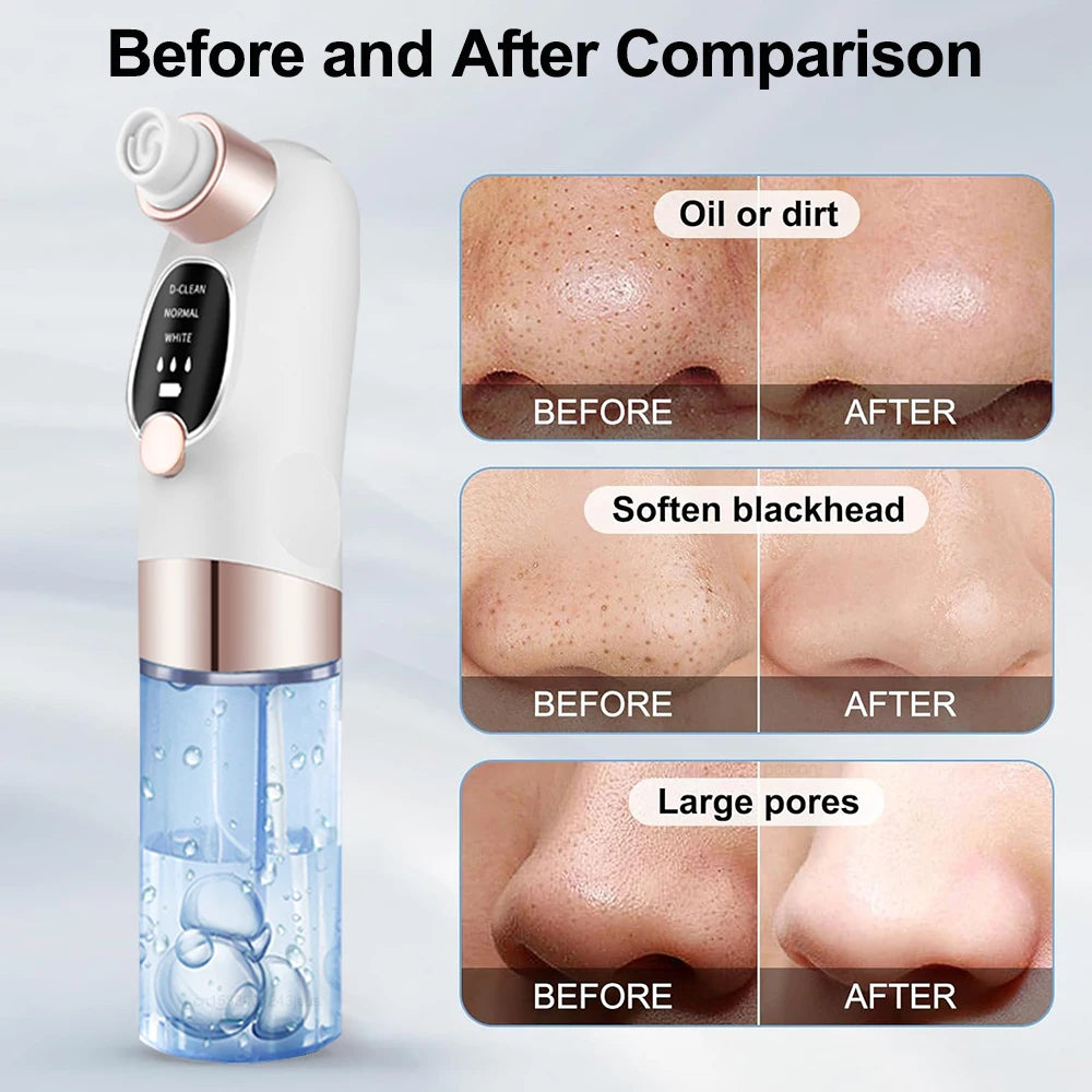 Blackhead Remover Electric BlackHead Extractor Pore Vacuum Cleaner Micro Small Bubble Acne Nose Deep Cleaning Black Head Remover